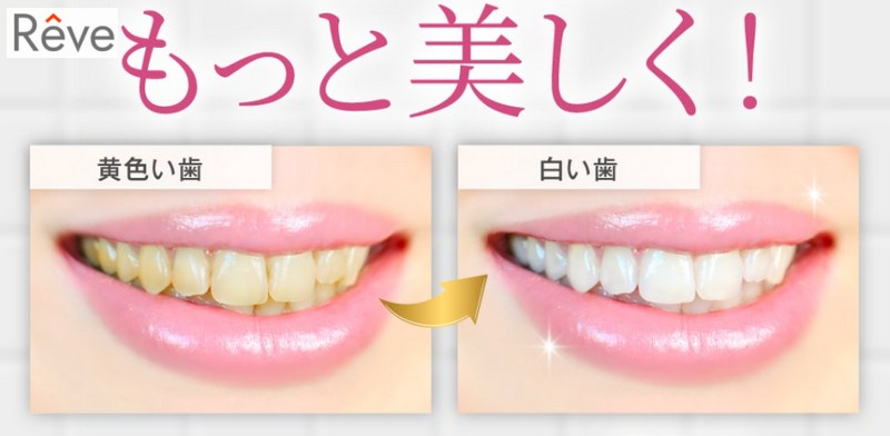 SNS�Řb��I�|�\�l�������p�I�{�yReve�I�[�K�j�b�N���݂������z���T�C�g